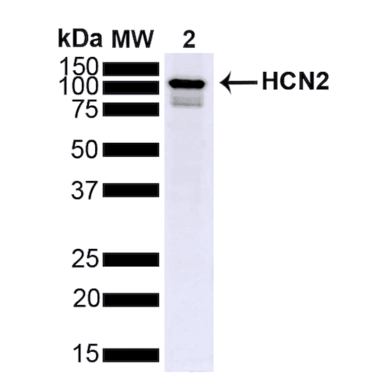 Western Blot - Anti-HCN2 Antibody [S71] (A304767) - Antibodies.com