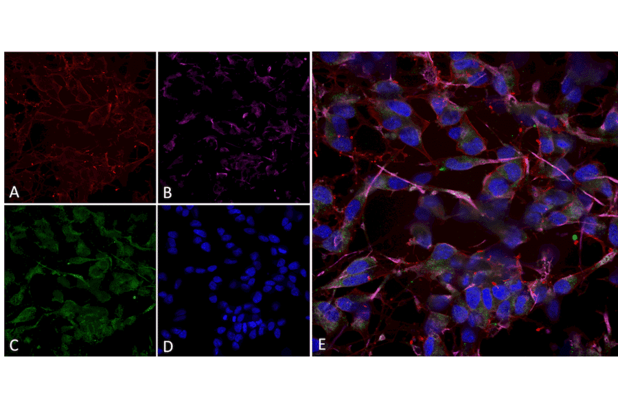 Immunocytochemistry/Immunofluorescence - Anti-HCN2 Antibody [S71] (A304767) - Antibodies.com