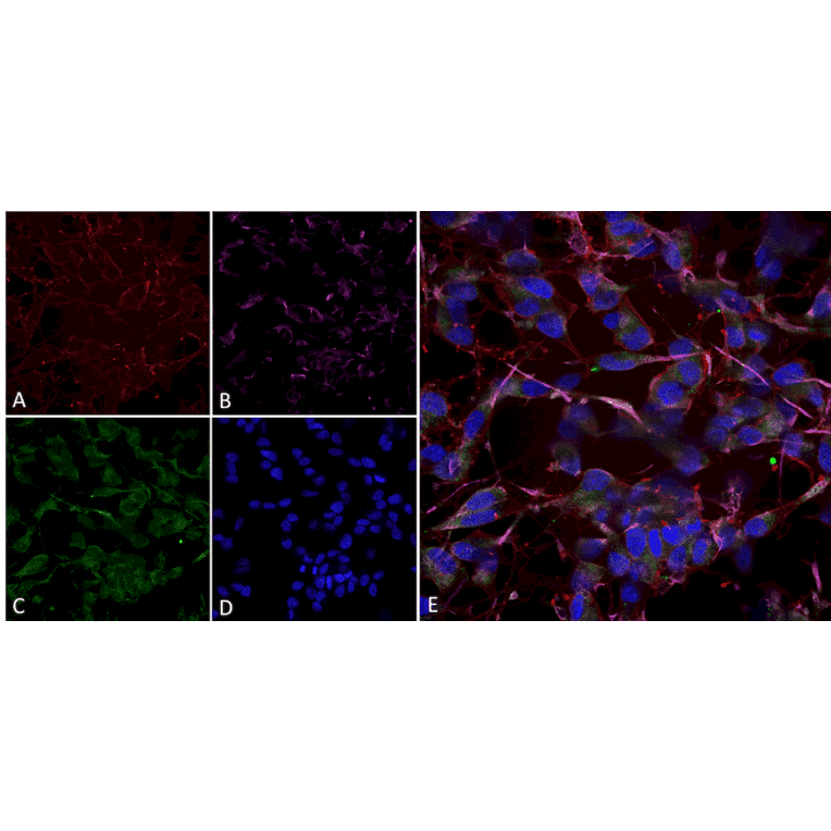 Immunocytochemistry/Immunofluorescence - Anti-HCN2 Antibody [S71] (A304767) - Antibodies.com