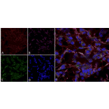 Immunocytochemistry/Immunofluorescence - Anti-HCN2 Antibody [S71] (A304767) - Antibodies.com