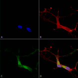 Immunocytochemistry/Immunofluorescence - Anti-HCN1 Antibody [S70] (A304768) - Antibodies.com