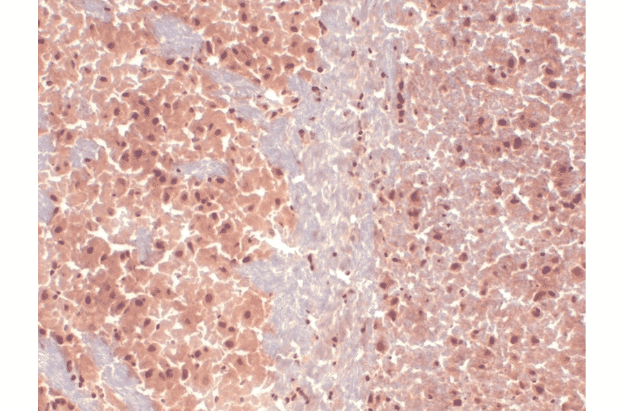 Immunohistochemistry - Anti-HCN1 Antibody [S70] (A304768) - Antibodies.com