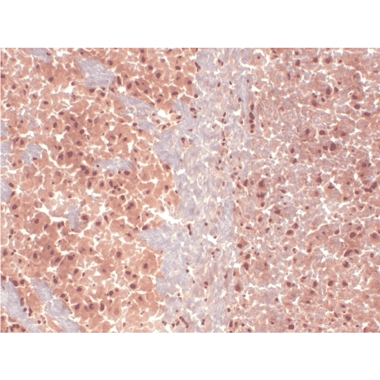 Immunohistochemistry - Anti-HCN1 Antibody [S70] (A304768) - Antibodies.com