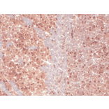 Immunohistochemistry - Anti-HCN1 Antibody [S70] (A304768) - Antibodies.com