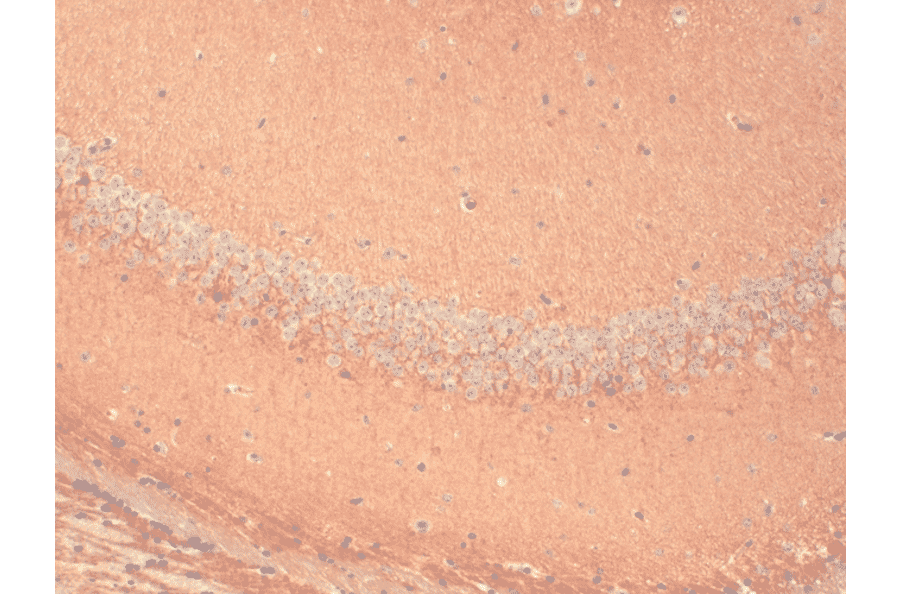 Immunohistochemistry - Anti-HCN1 Antibody [S70] (A304768) - Antibodies.com