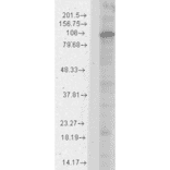 Western Blot - Anti-HCN1 Antibody [S70] (A304768) - Antibodies.com