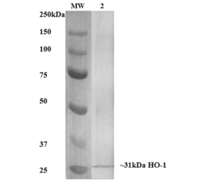 Western Blot - Anti-Heme Oxygenase 1 Antibody [6B8-2F2] (A304770) - Antibodies.com