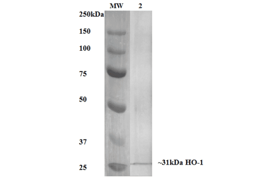 Western Blot - Anti-Heme Oxygenase 1 Antibody [6B8-2F2] (A304770) - Antibodies.com