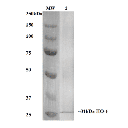 Western Blot - Anti-Heme Oxygenase 1 Antibody [6B8-2F2] (A304770) - Antibodies.com
