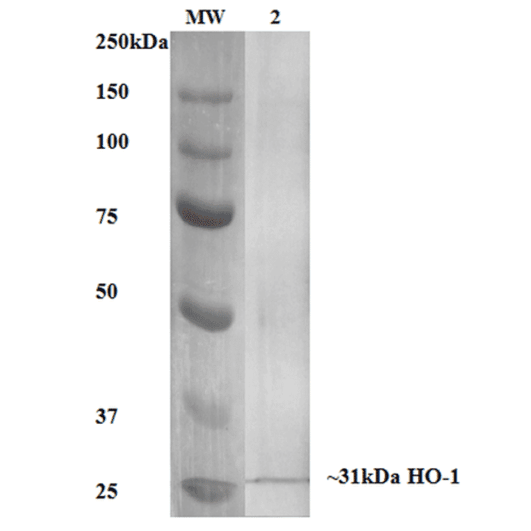 Western Blot - Anti-Heme Oxygenase 1 Antibody [6B8-2F2] (A304770) - Antibodies.com