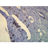 Immunohistochemistry - Anti-HSP70 Antibody [C92F3A-5] (A304773) - Antibodies.com