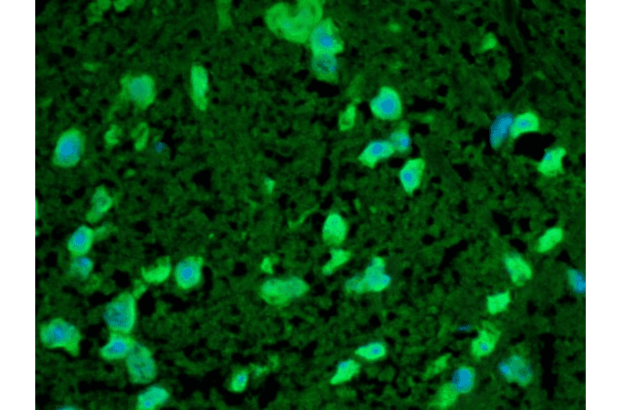 Immunohistochemistry - Anti-HSP22 Antibody (A304777) - Antibodies.com