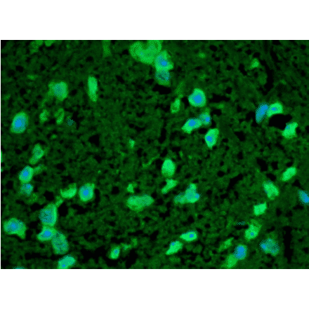 Immunohistochemistry - Anti-HSP22 Antibody (A304777) - Antibodies.com
