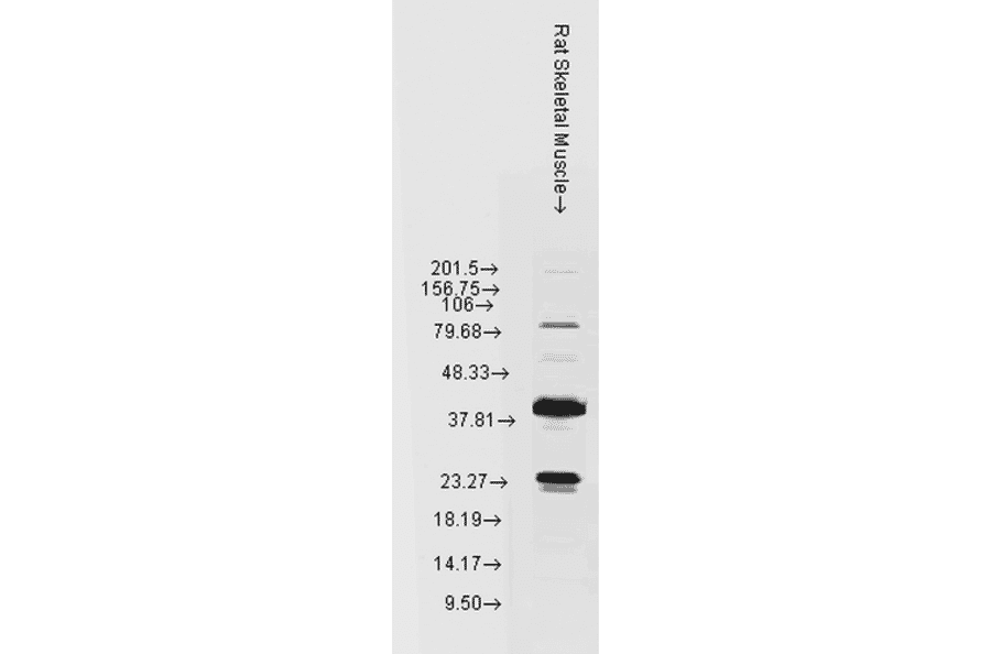 Western Blot - Anti-HSP22 Antibody (A304777) - Antibodies.com