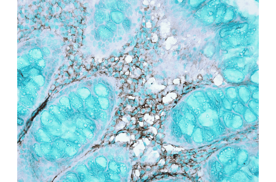 Immunohistochemistry - Anti-HSC70 Antibody (A304779) - Antibodies.com