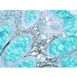 Immunohistochemistry - Anti-HSC70 Antibody (A304779) - Antibodies.com