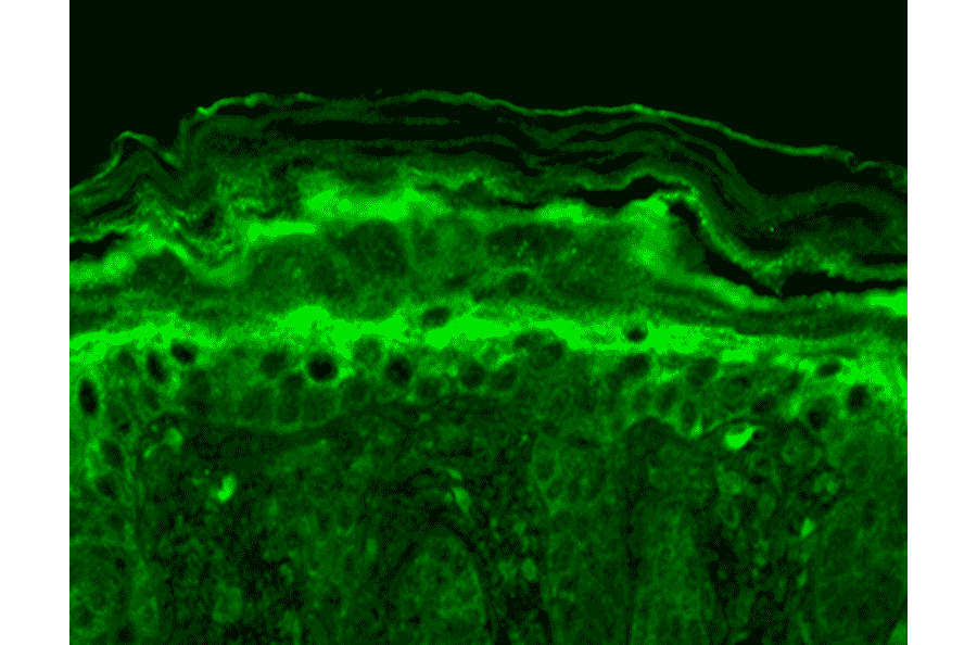 Immunohistochemistry - Anti-KCNT1 / SLACK Antibody [N3/26] (A304785) - Antibodies.com