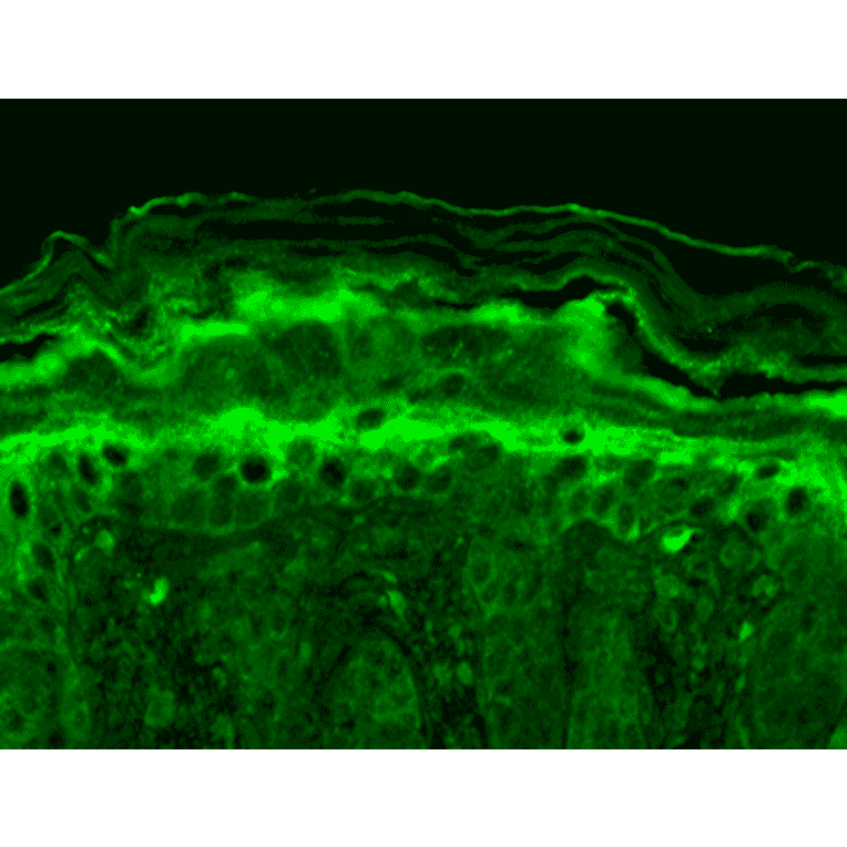 Immunohistochemistry - Anti-KCNT1 / SLACK Antibody [N3/26] (A304785) - Antibodies.com