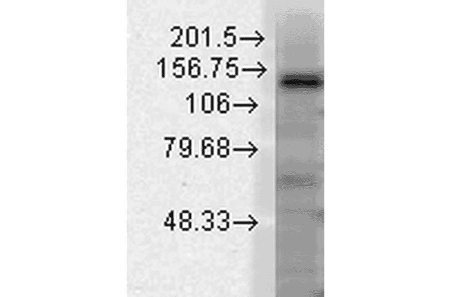 Western Blot - Anti-KCNT1 / SLACK Antibody [N3/26] (A304785) - Antibodies.com