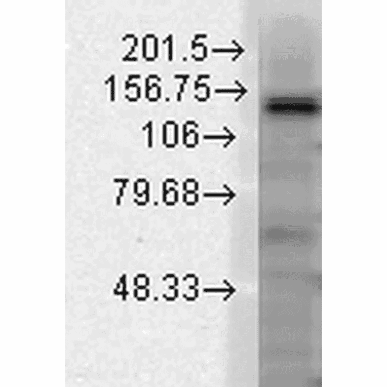 Western Blot - Anti-KCNT1 / SLACK Antibody [N3/26] (A304785) - Antibodies.com