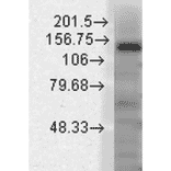Western Blot - Anti-KCNT1 / SLACK Antibody [N3/26] (A304785) - Antibodies.com