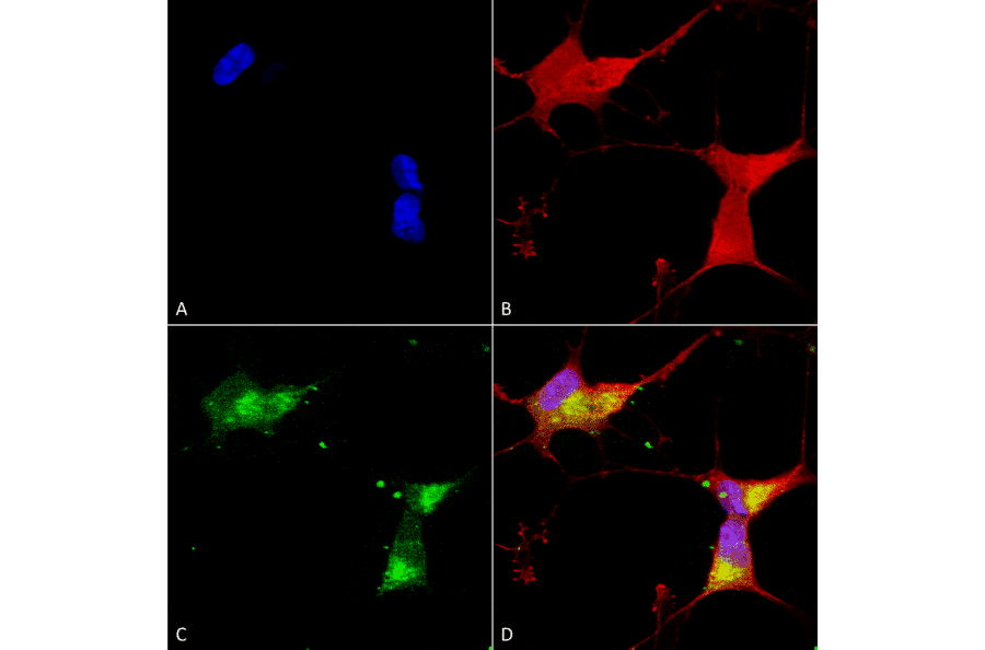 Immunocytochemistry/Immunofluorescence - Anti-Kir2.1 Antibody [S112] (A304786) - Antibodies.com