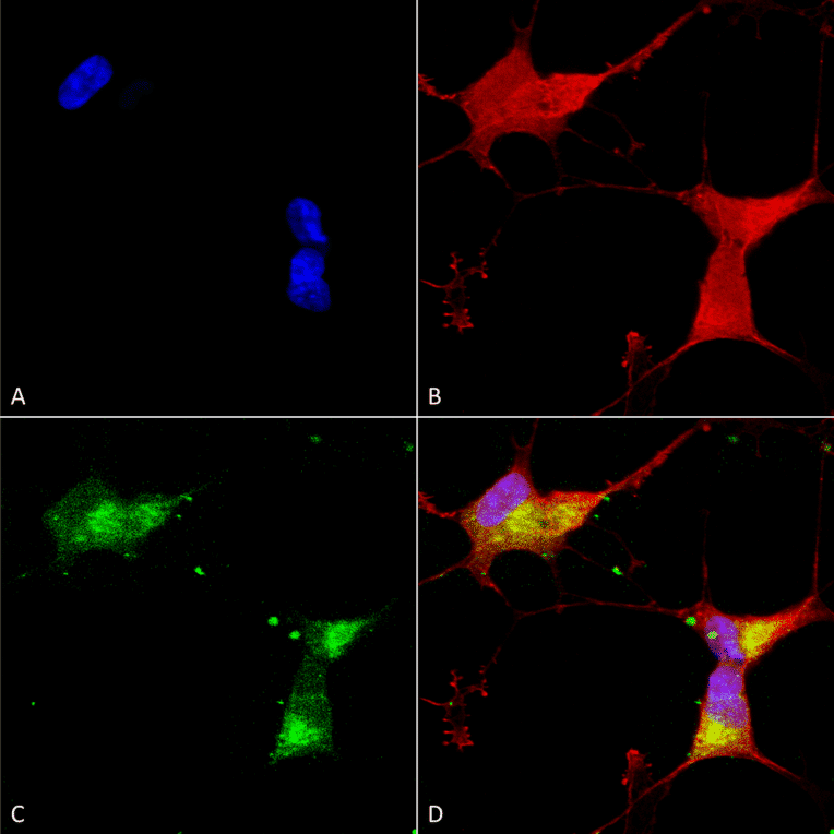 Immunocytochemistry/Immunofluorescence - Anti-Kir2.1 Antibody [S112] (A304786) - Antibodies.com