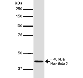 Western Blot - Anti-SCN3B Antibody [S396-29] (A304789) - Antibodies.com
