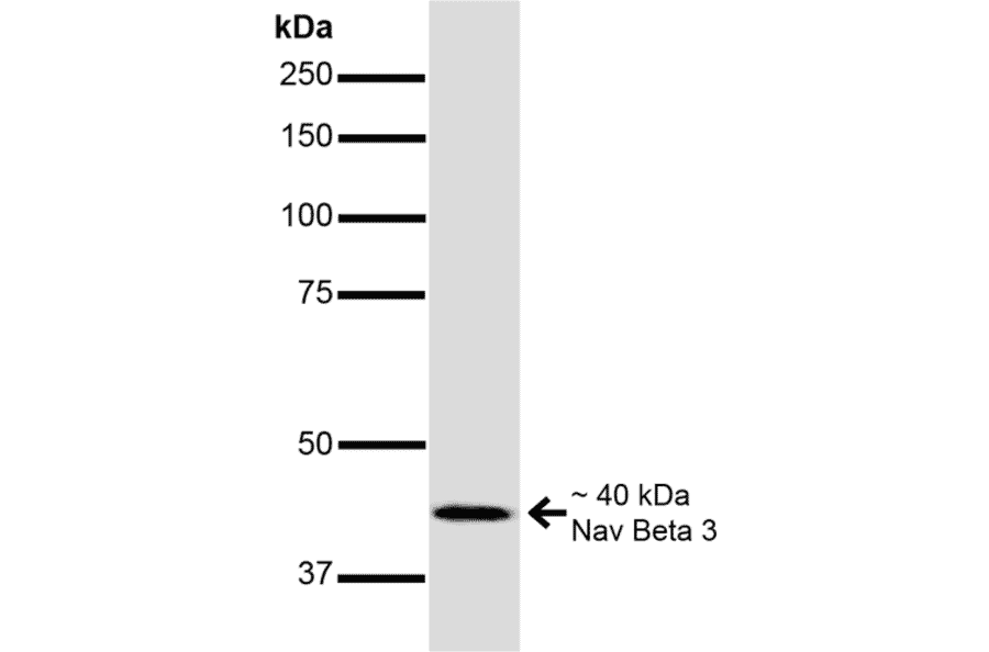Western Blot - Anti-SCN3B Antibody [S396-29] (A304789) - Antibodies.com