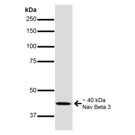 Western Blot - Anti-SCN3B Antibody [S396-29] (A304789) - Antibodies.com