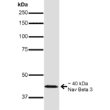 Western Blot - Anti-SCN3B Antibody [S396-29] (A304789) - Antibodies.com