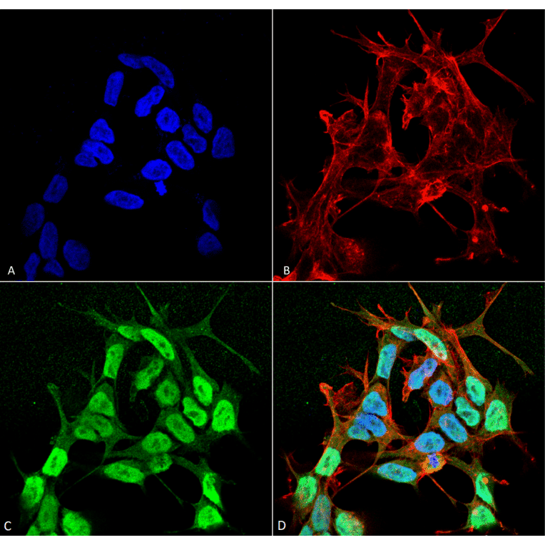Immunocytochemistry/Immunofluorescence - Anti-SCN3B Antibody [S396-29] (A304789) - Antibodies.com