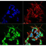 Immunocytochemistry/Immunofluorescence - Anti-SCN3B Antibody [S396-29] (A304789) - Antibodies.com