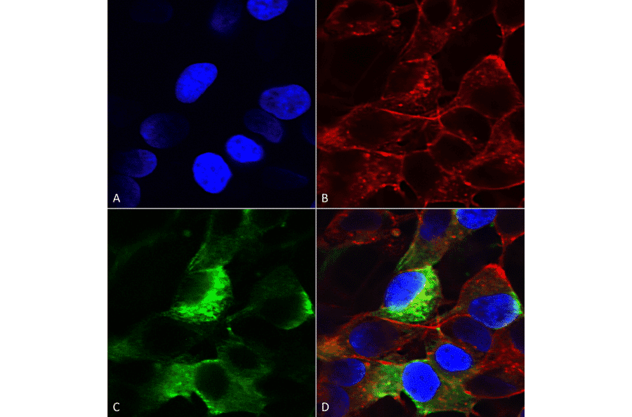 Immunocytochemistry/Immunofluorescence - Anti-SCN3B Antibody [S396-29] (A304789) - Antibodies.com