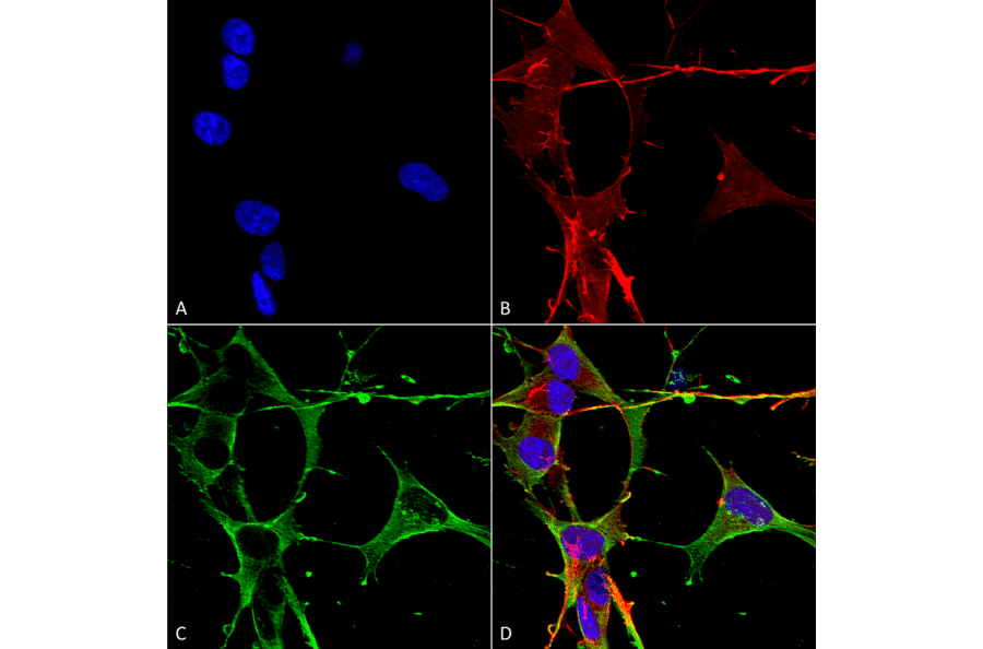 Immunocytochemistry/Immunofluorescence - Anti-Neuroligin 3 Antibody [S110-29] (A304790) - Antibodies.com