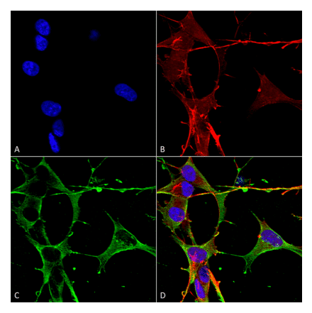 Immunocytochemistry/Immunofluorescence - Anti-Neuroligin 3 Antibody [S110-29] (A304790) - Antibodies.com