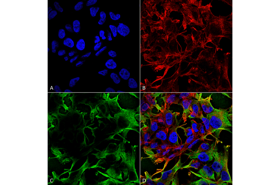 Immunocytochemistry/Immunofluorescence - Anti-Neuroligin 3 Antibody [S110-29] (A304790) - Antibodies.com