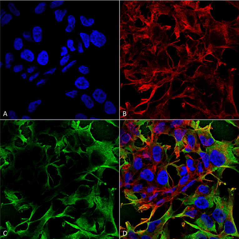 Immunocytochemistry/Immunofluorescence - Anti-Neuroligin 3 Antibody [S110-29] (A304790) - Antibodies.com