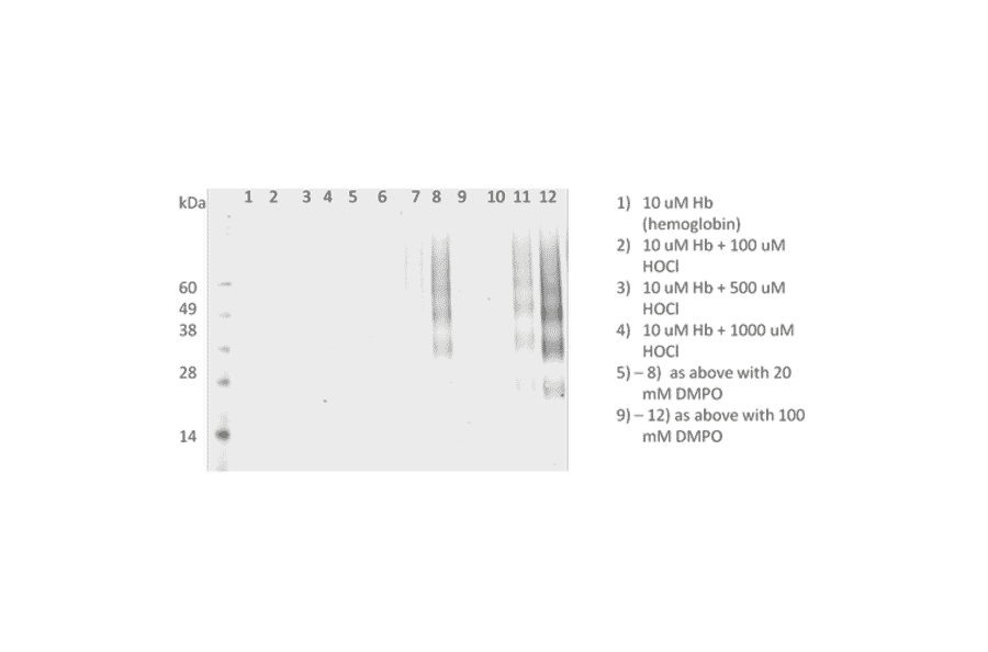Western Blot - Anti-DMPO Antibody [N1664A] (A304793) - Antibodies.com