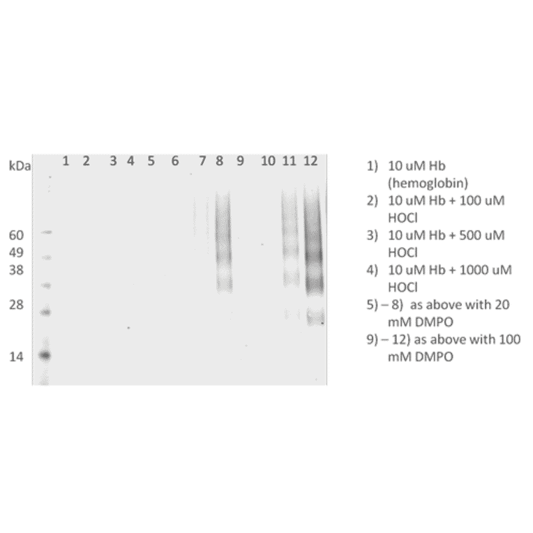 Western Blot - Anti-DMPO Antibody [N1664A] (A304793) - Antibodies.com