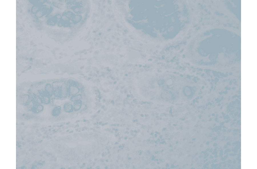 Immunohistochemistry - Anti-Nitrotyrosine Antibody [39B6] (A304794) - Antibodies.com