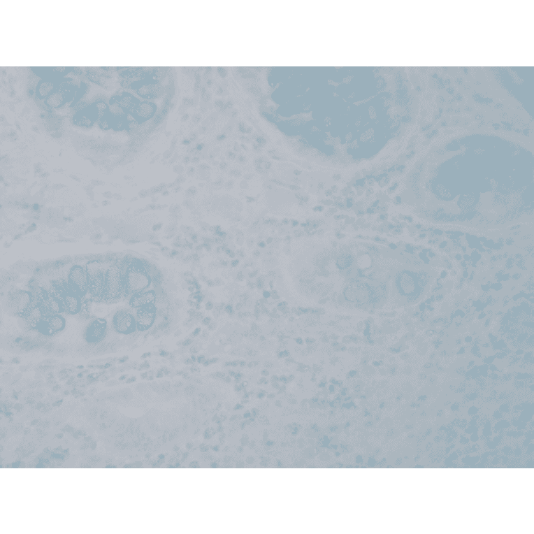 Immunohistochemistry - Anti-Nitrotyrosine Antibody [39B6] (A304794) - Antibodies.com