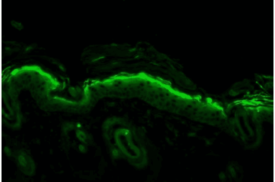 Immunohistochemistry - Anti-Nitrotyrosine Antibody [39B6] (A304794) - Antibodies.com