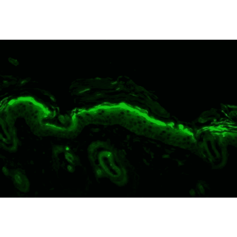 Immunohistochemistry - Anti-Nitrotyrosine Antibody [39B6] (A304794) - Antibodies.com
