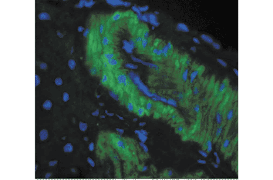 Immunohistochemistry - Anti-Nitrotyrosine Antibody [39B6] (A304794) - Antibodies.com