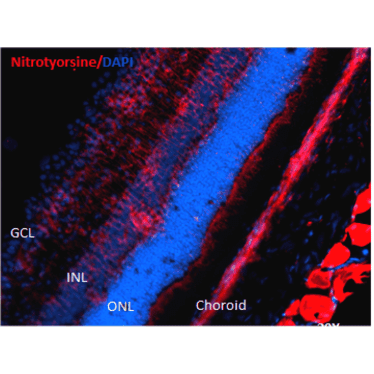 Immunohistochemistry - Anti-Nitrotyrosine Antibody [39B6] (A304794) - Antibodies.com