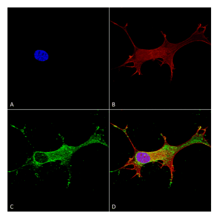 Immunocytochemistry/Immunofluorescence - Anti-Notch1 Antibody [S253-32] (A304795) - Antibodies.com