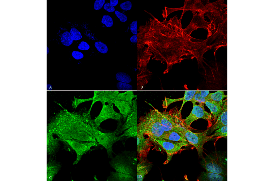 Immunocytochemistry/Immunofluorescence - Anti-Notch1 Antibody [S253-32] (A304795) - Antibodies.com