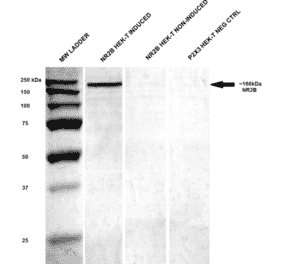 Western Blot - Anti-NMDAR2B Antibody [S59] (A304796) - Antibodies.com