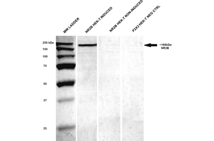 Western Blot - Anti-NMDAR2B Antibody [S59] (A304796) - Antibodies.com